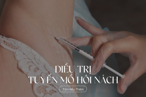Điều trị tuyến mồ hôi nách